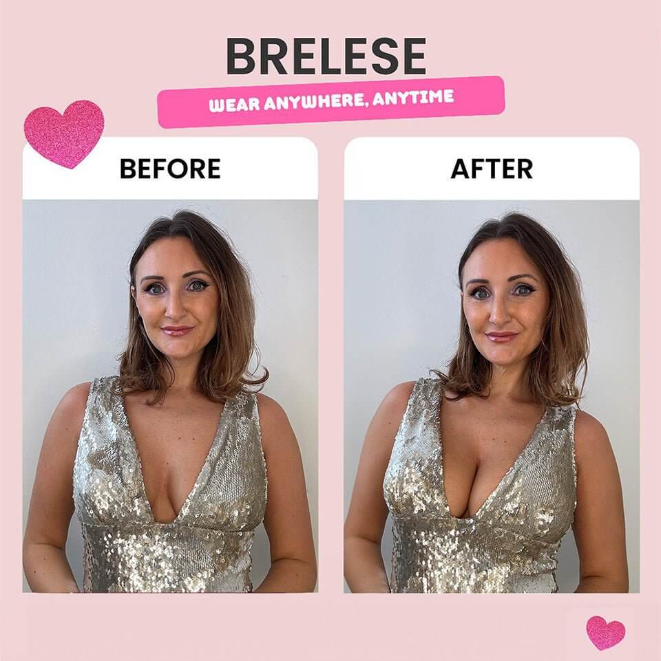 Model in a green dress dress wearing the sticky bra inserts, with the before effect on the left and the after result on the right.